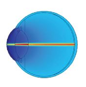 3D Optical Human Eye Model Based on COMSOL Multiphysics® to Provide a Test ...