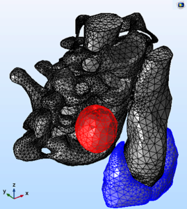 Impact of Different Modeling Approaches in Field Focusing Predictions of ...