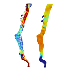 Developing a Growth Prediction Model of Abdominal Aortic Aneurysms via ...