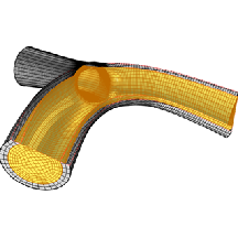 An Automated MATLAB®–COMSOL Pipeline for Cerebrovascular Fluid–Structure ...