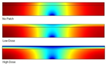 Simulation of Transdermal Toxin Expulsion via Adsorptive Dermal Patch using ...