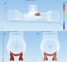 3D Analysis of Cavitation in Control Valve by Pressure Variation