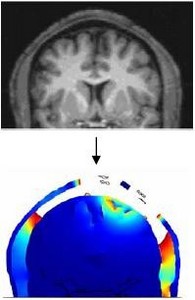 Electrical Stimulation of Brain using a realistic 3D Human Head Model: ...