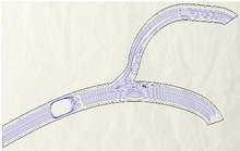 Fluid Dynamics of Blood Flow during Reperfusion and Post-conditioning