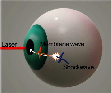 Simulation of Acoustically Excited Membrane Waves on an Eye