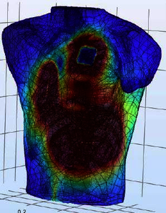 Model of the Cardiac Defibrillation Induced by an Implantable Defibrillator ...